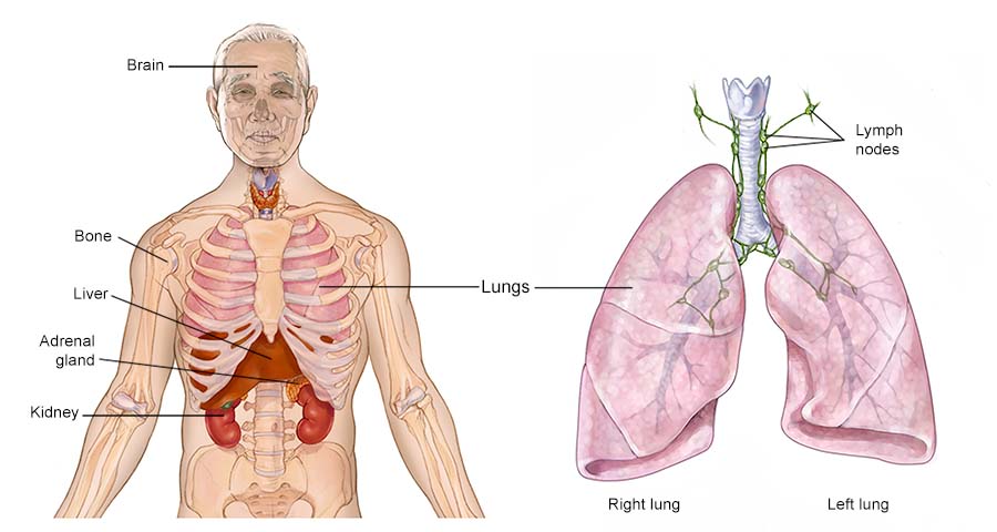 Illustration of the lungs in the body.