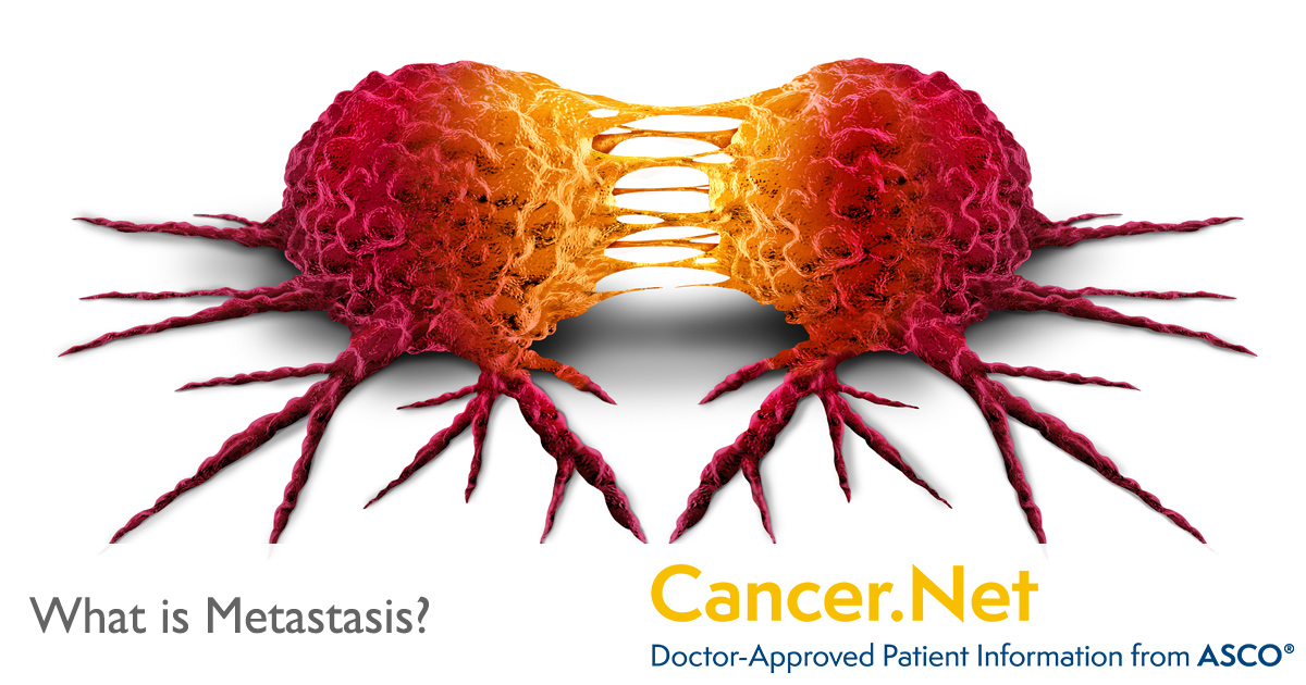 What is Metastasis? | Cancer.Net