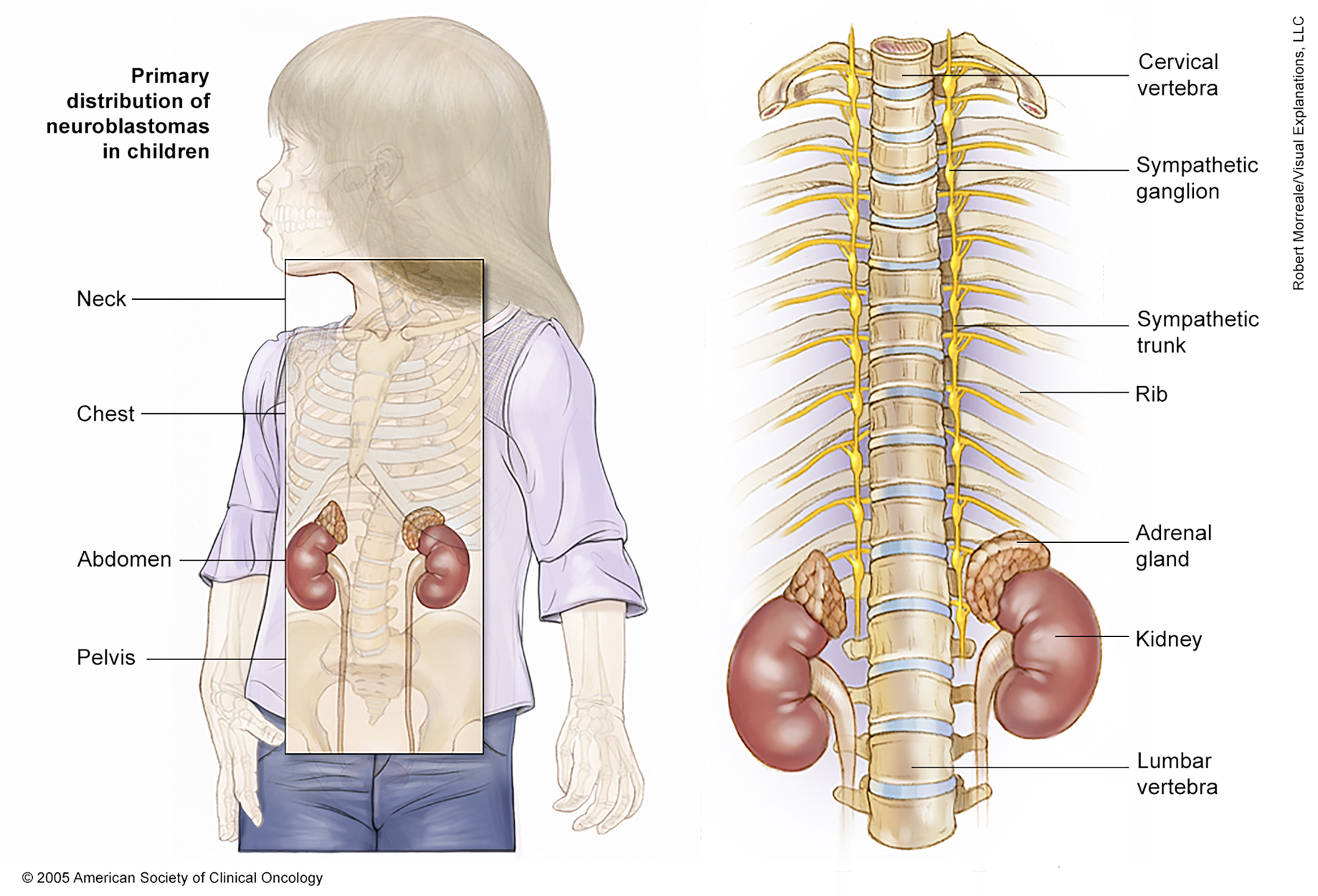 Illustration of a child's neurological system including the spinal cord and main nerve systems. See description for more information. 