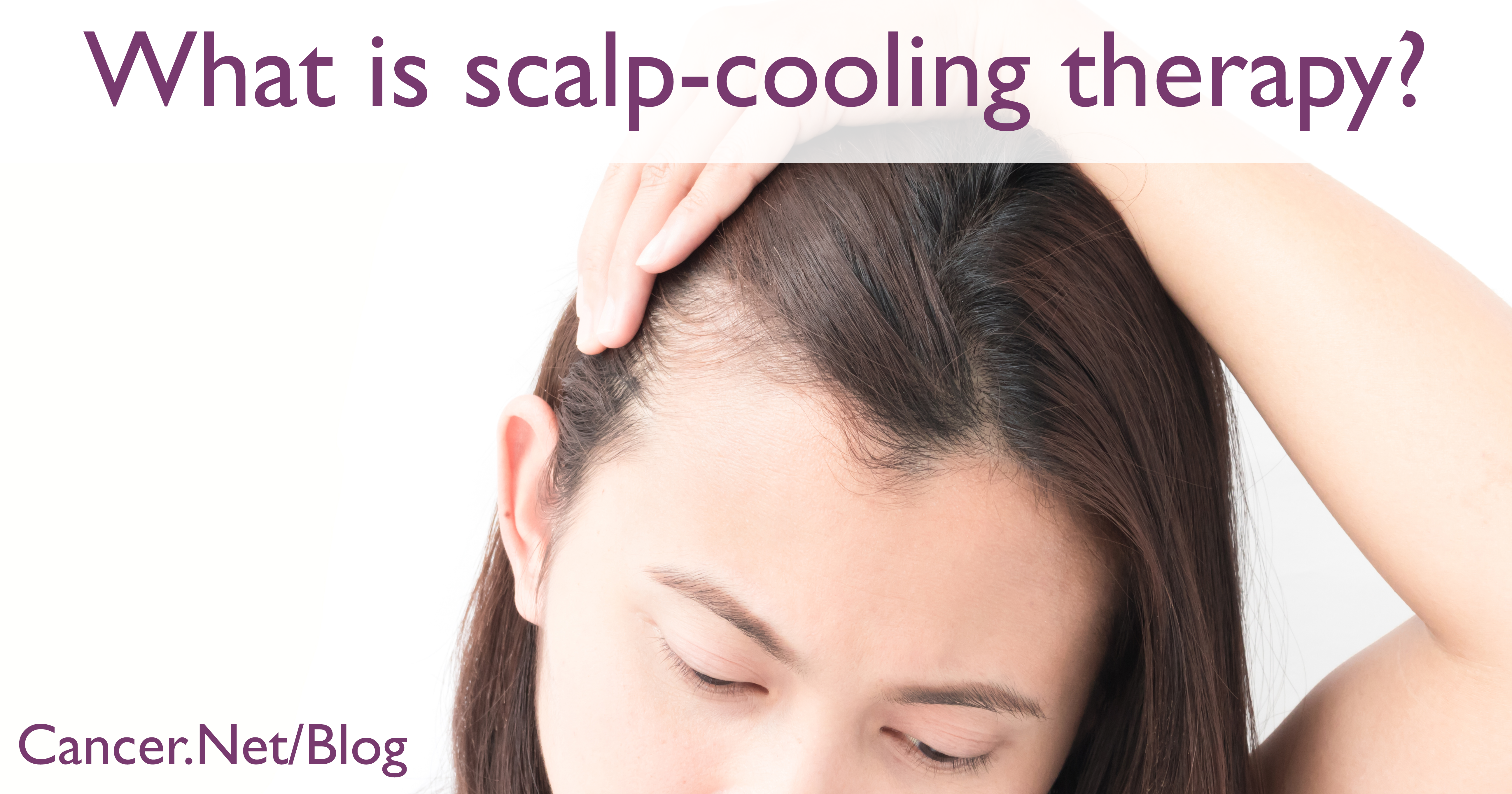klinke panel er der Hair Loss or Alopecia | Cancer.Net