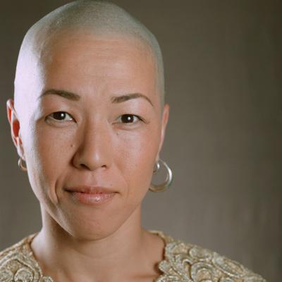4 Things to Ask About Cancer and Hair Loss 