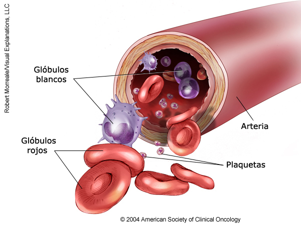Childhood Leukemia Anatomy