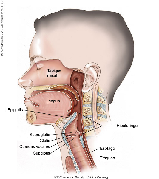 Ilustracion médica de cáncer laríngeo e hipofaríngeo