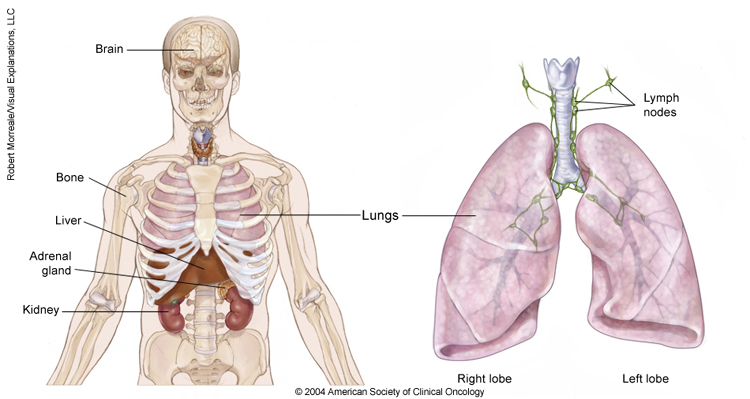 Illustration of the lungs in the body.