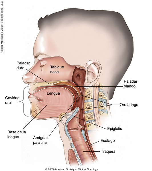 Ilustracion médica de cáncer oral y orofaríngeo