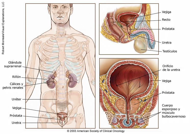 Prostate Cancer Illustration
